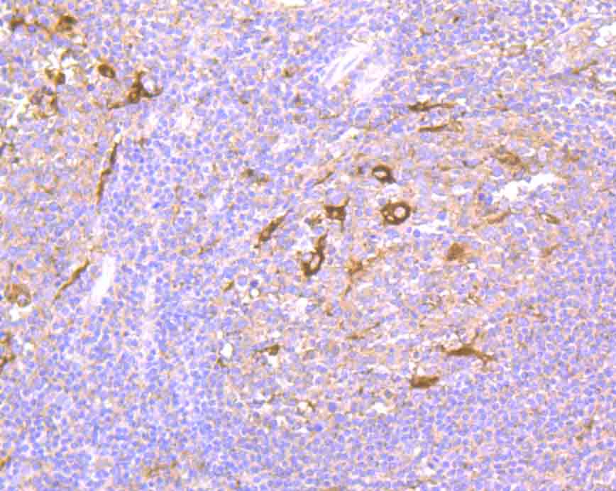 Immunohistochemical analysis of paraffin-embedded human tonsil tissue using anti-NCK1 antibody. The section was pre-treated using heat mediated antigen retrieval with Tris-EDTA buffer (pH 9.0) for 20 minutes.The tissues were blocked in 1% BSA for 30 minutes at room temperature, washed with ddH2O and PBS, and then probed with the primary antibody (ET7106-57, 1/50) for 30 minutes at room temperature. The detection was performed using an HRP conjugated compact polymer system. DAB was used as the chromogen. Tissues were counterstained with hematoxylin and mounted with DPX.