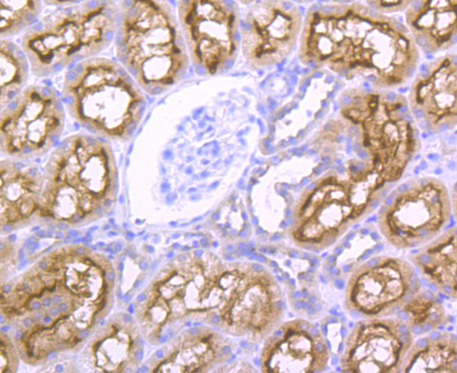 Immunohistochemical analysis of paraffin-embedded human kidney tissue using anti-NCK1 antibody. The section was pre-treated using heat mediated antigen retrieval with Tris-EDTA buffer (pH 9.0) for 20 minutes.The tissues were blocked in 1% BSA for 30 minutes at room temperature, washed with ddH2O and PBS, and then probed with the primary antibody (ET7106-57, 1/50) for 30 minutes at room temperature. The detection was performed using an HRP conjugated compact polymer system. DAB was used as the chromogen. Tissues were counterstained with hematoxylin and mounted with DPX.