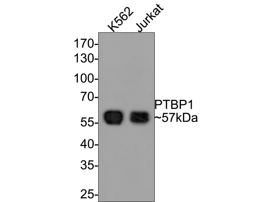 Western blot analysis of PTBP1 on different lysates with Rabbit anti-PTBP1 antibody (ET7106-58) at 1/500 dilution.<br />
<br />
Lane 1: K562 cell lysate<br />
Lane 2: Jurkat cell lysate<br />
<br />
Lysates/proteins at 10 µg/Lane.<br />
<br />
Predicted band size: 57 kDa<br />
Observed band size: 57 kDa<br />
<br />
Exposure time: 1 minute;<br />
<br />
10% SDS-PAGE gel.<br />
<br />
Proteins were transferred to a PVDF membrane and blocked with 5% NFDM/TBST for 1 hour at room temperature. The primary antibody (ET7106-58) at 1/500 dilution was used in 5% NFDM/TBST at room temperature for 2 hours. Goat Anti-Rabbit IgG - HRP Secondary Antibody (HA1001) at 1:200,000 dilution was used for 1 hour at room temperature.