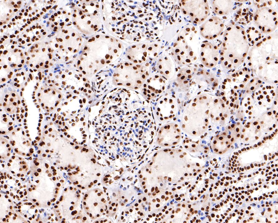 Immunohistochemical analysis of paraffin-embedded human kidney tissue with Rabbit anti-PTBP1 antibody (ET7106-58) at 1/400 dilution.<br />
<br />
The section was pre-treated using heat mediated antigen retrieval with sodium citrate buffer (pH 6.0) for 2 minutes. The tissues were blocked in 1% BSA for 20 minutes at room temperature, washed with ddH2O and PBS, and then probed with the primary antibody (ET7106-58) at 1/400 dilution for 1 hour at room temperature. The detection was performed using an HRP conjugated compact polymer system. DAB was used as the chromogen. Tissues were counterstained with hematoxylin and mounted with DPX.