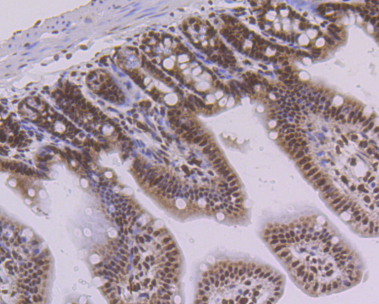 Immunohistochemical analysis of paraffin-embedded mouse colon tissue using anti-PTBP1 antibody. The section was pre-treated using heat mediated antigen retrieval with Tris-EDTA buffer (pH 9.0) for 20 minutes.The tissues were blocked in 1% BSA for 30 minutes at room temperature, washed with ddH2O and PBS, and then probed with the primary antibody (ET7106-58, 1/50) for 30 minutes at room temperature. The detection was performed using an HRP conjugated compact polymer system. DAB was used as the chromogen. Tissues were counterstained with hematoxylin and mounted with DPX.