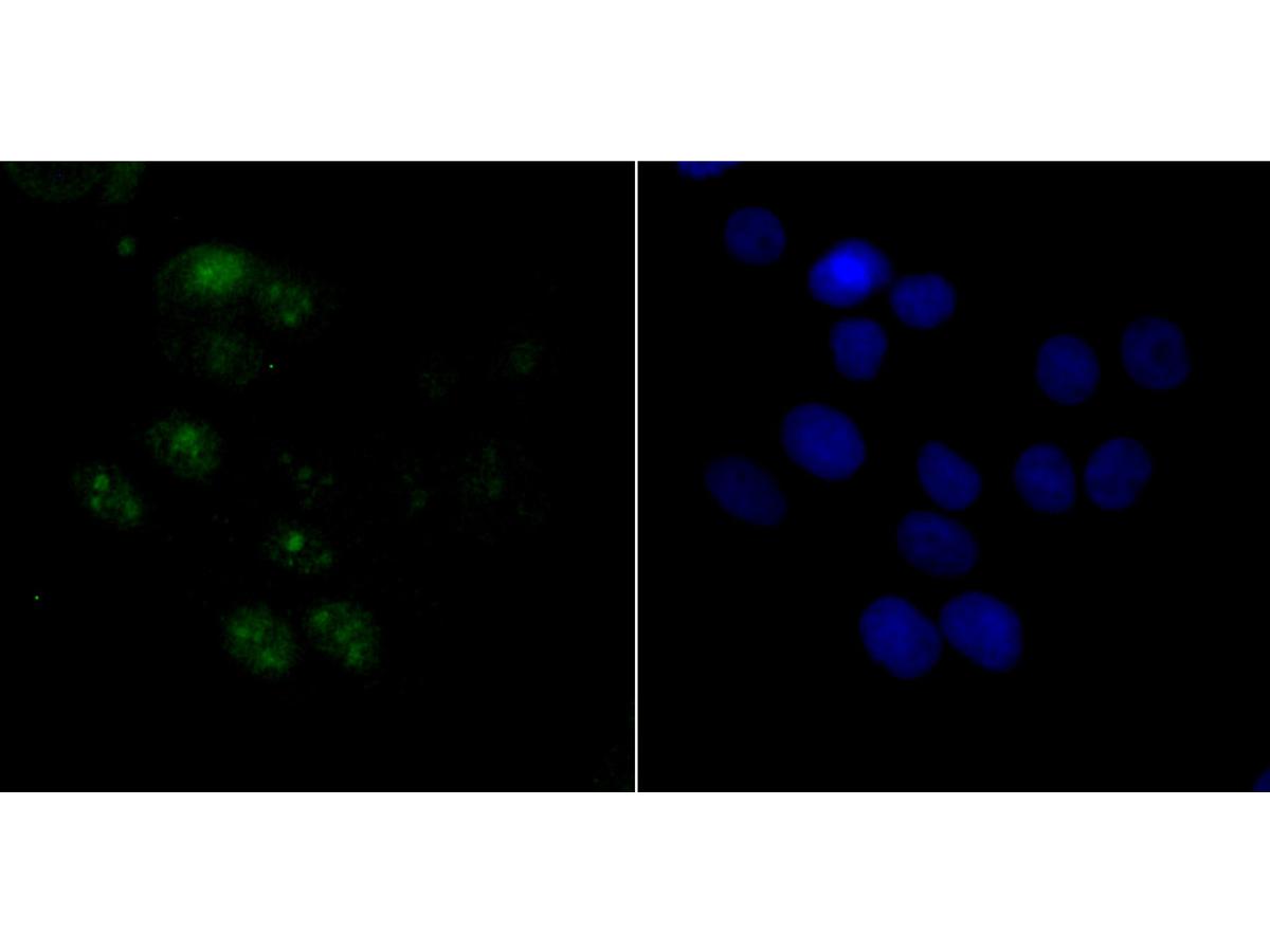 ICC staining ACTL6A in LOVO cells (green). The nuclear counter stain is DAPI (blue). Cells were fixed in paraformaldehyde, permeabilised with 0.25% Triton X100/PBS.