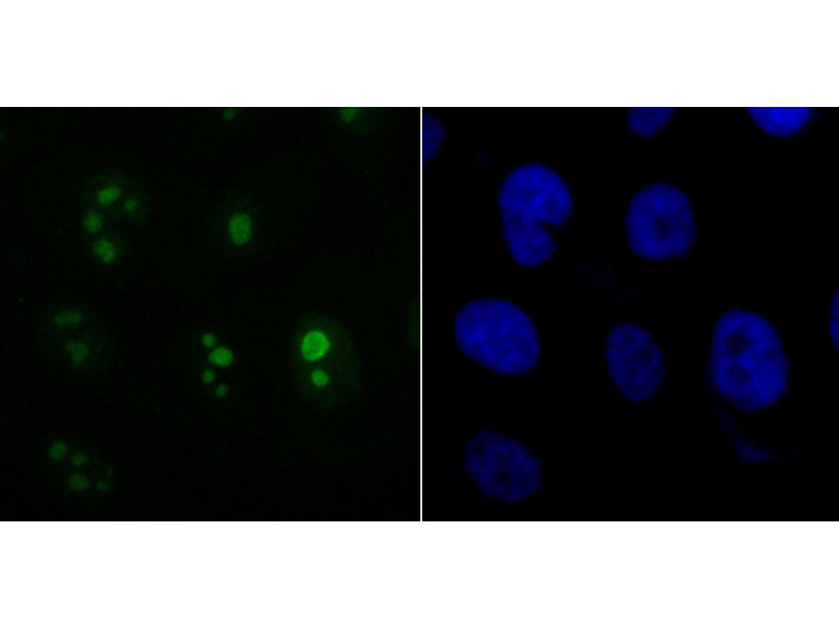 ICC staining ACTL6A in PC-3M cells (green). The nuclear counter stain is DAPI (blue). Cells were fixed in paraformaldehyde, permeabilised with 0.25% Triton X100/PBS.