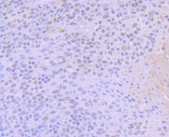 Immunohistochemical analysis of paraffin-embedded human tonsil tissue using anti-ACTL6A antibody. Counter stained with hematoxylin.