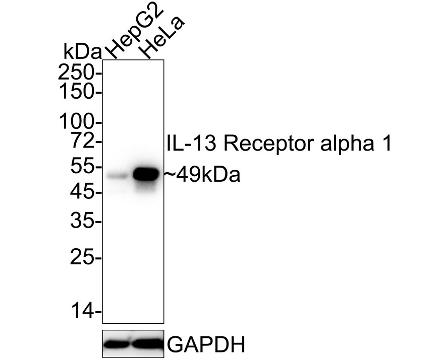 Western blot analysis of IL13 Receptor alpha 1 on HepG2 cell lysates. Proteins were transferred to a PVDF membrane and blocked with 5% BSA in PBS for 1 hour at room temperature. The primary antibody (ET7106-61, 1/500) was used in 5% BSA at room temperature for 2 hours. Goat Anti-Rabbit IgG - HRP Secondary Antibody (HA1001) at 1:200,000 dilution was used for 1 hour at room temperature.