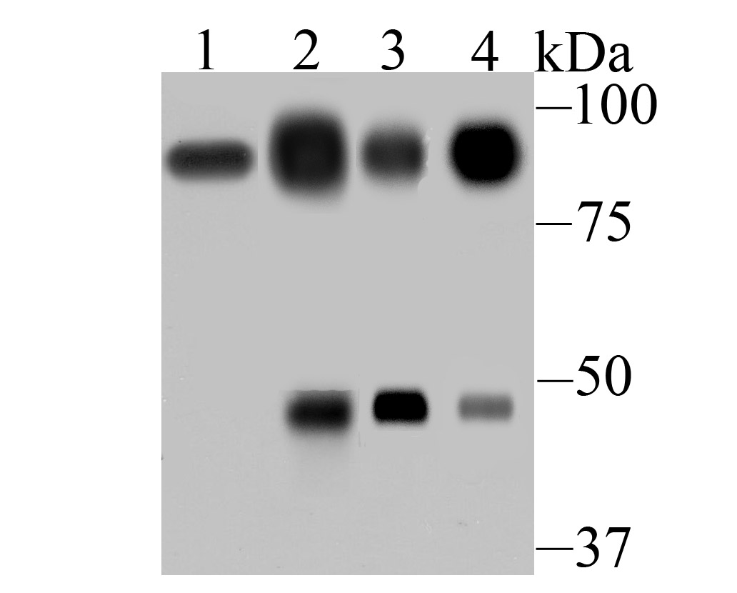 Western blot analysis of villin1 on different lysates. Proteins were transferred to a PVDF membrane and blocked with 5% BSA in PBS for 1 hour at room temperature. The primary antibody (ET7106-62, 1/500) was used in 5% BSA at room temperature for 2 hours. Goat Anti-Rabbit IgG - HRP Secondary Antibody (HA1001) at 1:5,000 dilution was used for 1 hour at room temperature.<br />
Positive control: <br />
Lane 1: Mouse colon tissue lysate<br />
Lane 2: Human small intestine tissue lysate<br />
Lane 3: Human colon tissue lysate<br />
Lane 4: Rat kidney tissue lysate