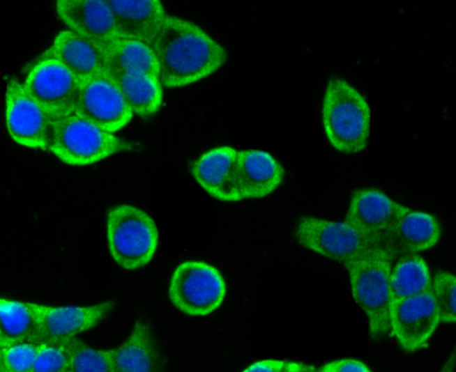 ICC staining of villin1 in LOVO cells (green). Formalin fixed cells were permeabilized with 0.1% Triton X-100 in TBS for 10 minutes at room temperature and blocked with 1% Blocker BSA for 15 minutes at room temperature. Cells were probed with the primary antibody (ET7106-62, 1/500) for 1 hour at room temperature, washed with PBS. Alexa Fluor®488 Goat anti-Rabbit IgG was used as the secondary antibody at 1/1,000 dilution. The nuclear counter stain is DAPI (blue).