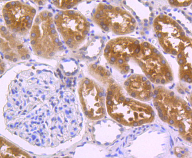 Immunohistochemical analysis of paraffin-embedded human kidney tissue using anti-villin1 antibody. The section was pre-treated using heat mediated antigen retrieval with Tris-EDTA buffer (pH 8.0-8.4) for 20 minutes.The tissues were blocked in 5% BSA for 30 minutes at room temperature, washed with ddH2O and PBS, and then probed with the primary antibody (ET7106-62, 1/200) for 30 minutes at room temperature. The detection was performed using an HRP conjugated compact polymer system. DAB was used as the chromogen. Tissues were counterstained with hematoxylin and mounted with DPX.