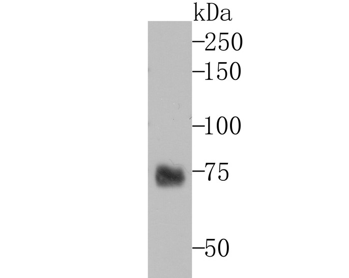 Western blot analysis of TRP1 on melanoma tissue lysates. Proteins were transferred to a PVDF membrane and blocked with 5% BSA in PBS for 1 hour at room temperature. The primary antibody (ET7106-66, 1/500) was used in 5% BSA at room temperature for 2 hours. Goat Anti-Rabbit IgG - HRP Secondary Antibody (HA1001) at 1:200,000 dilution was used for 1 hour at room temperature.
