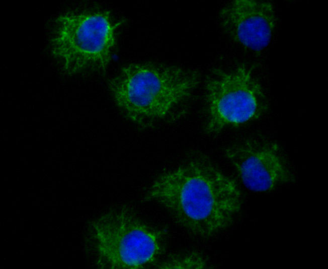 ICC staining of TRP1 in HUVEC cells (green). Formalin fixed cells were permeabilized with 0.1% Triton X-100 in TBS for 10 minutes at room temperature and blocked with 10% negative goat serum for 15 minutes at room temperature. Cells were probed with the primary antibody (ET7106-66, 1/50) for 1 hour at room temperature, washed with PBS. Alexa Fluor®488 conjugate-Goat anti-Rabbit IgG was used as the secondary antibody at 1/1,000 dilution. The nuclear counter stain is DAPI (blue).
