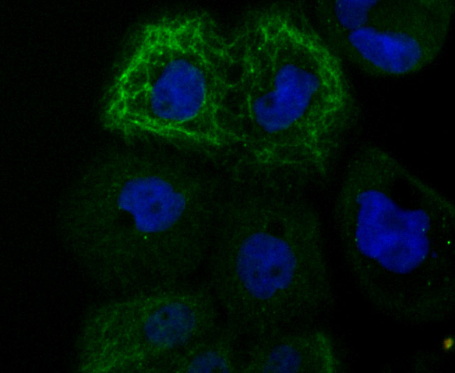 ICC staining of TRP1 in A431 cells (green). Formalin fixed cells were permeabilized with 0.1% Triton X-100 in TBS for 10 minutes at room temperature and blocked with 10% negative goat serum for 15 minutes at room temperature. Cells were probed with the primary antibody (ET7106-66, 1/50) for 1 hour at room temperature, washed with PBS. Alexa Fluor®488 conjugate-Goat anti-Rabbit IgG was used as the secondary antibody at 1/1,000 dilution. The nuclear counter stain is DAPI (blue).