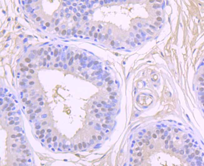 Immunohistochemical analysis of paraffin-embedded human breast tissue using anti-CSNK2B antibody. Counter stained with hematoxylin.