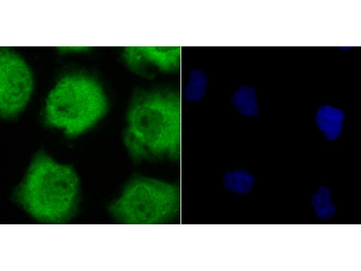 ICC staining of GLO1 in HUVEC cells (green). Formalin fixed cells were permeabilized with 0.1% Triton X-100 in TBS for 10 minutes at room temperature and blocked with 1% Blocker BSA for 15 minutes at room temperature. Cells were probed with the primary antibody (ET7106-68, 1/50) for 1 hour at room temperature, washed with PBS. Alexa Fluor®488 Goat anti-Rabbit IgG was used as the secondary antibody at 1/1,000 dilution. The nuclear counter stain is DAPI (blue).