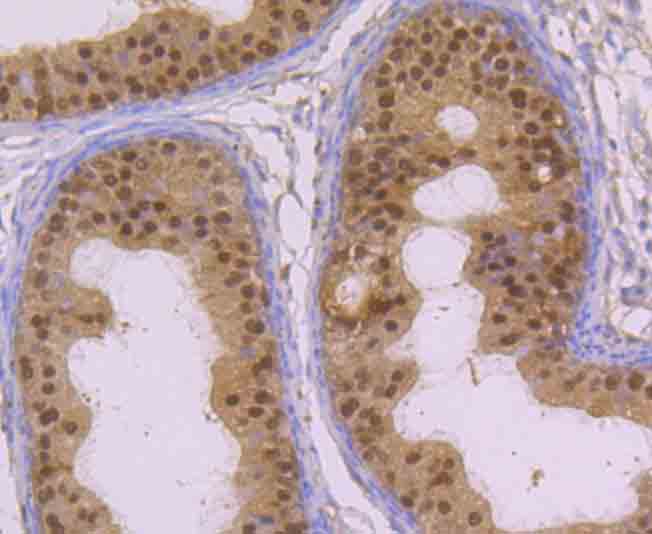 Immunohistochemical analysis of paraffin-embedded rat epididymis tissue using anti-GLO1 antibody. The section was pre-treated using heat mediated antigen retrieval with Tris-EDTA buffer (pH 8.0-8.4) for 20 minutes.The tissues were blocked in 5% BSA for 30 minutes at room temperature, washed with ddH2O and PBS, and then probed with the primary antibody (ET7106-68, 1/50) for 30 minutes at room temperature. The detection was performed using an HRP conjugated compact polymer system. DAB was used as the chromogen. Tissues were counterstained with hematoxylin and mounted with DPX.