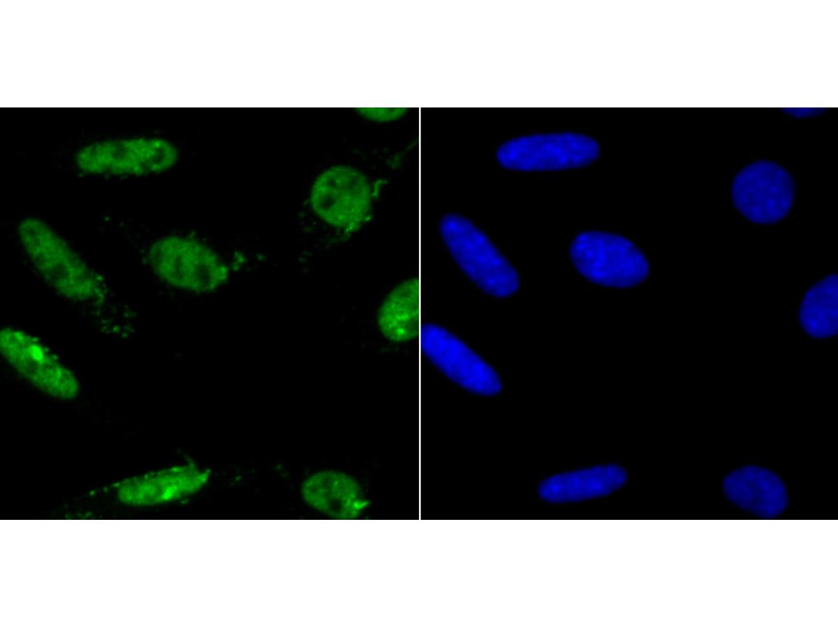ICC staining Mad2L1 in SH-SY5Y cells (green). The nuclear counter stain is DAPI (blue). Cells were fixed in paraformaldehyde, permeabilised with 0.25% Triton X100/PBS.