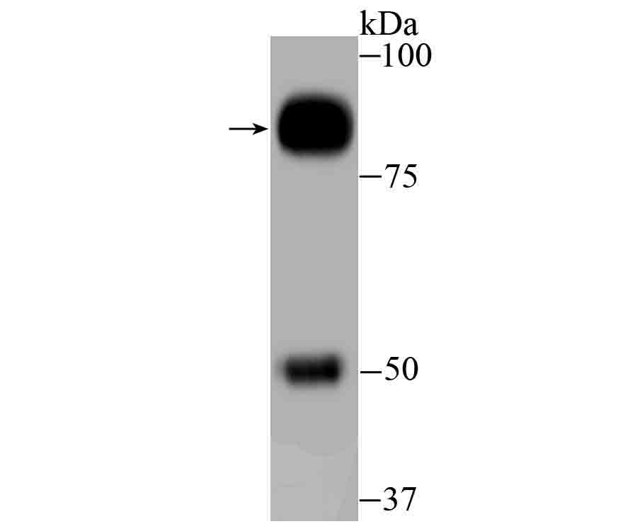 Western blot analysis of GAB1 on human small intestine tissue lysate using anti-GAB1 antibody at 1/500 dilution.