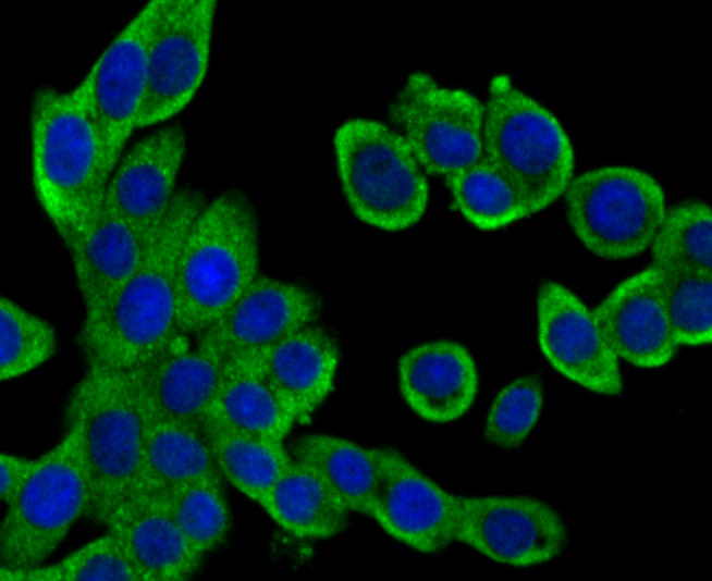 ICC staining GAB1 in LOVO cells (green). The nuclear counter stain is DAPI (blue). Cells were fixed in paraformaldehyde, permeabilised with 0.25% Triton X100/PBS.