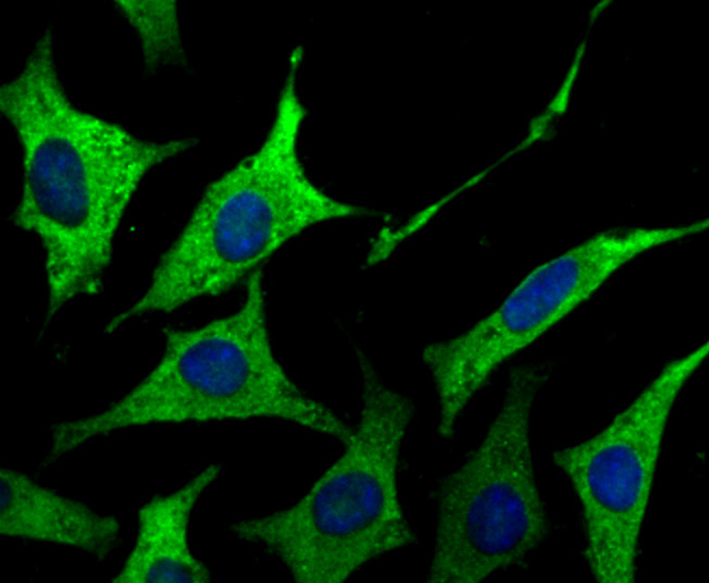 ICC staining GAB1 in SH-SY5Y cells (green). The nuclear counter stain is DAPI (blue). Cells were fixed in paraformaldehyde, permeabilised with 0.25% Triton X100/PBS.