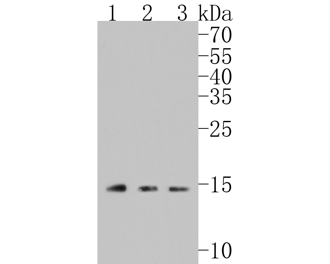Western blot analysis of SCGB1A1 on different lysates. Proteins were transferred to a PVDF membrane and blocked with 5% BSA in PBS for 1 hour at room temperature. The primary antibody (ET7106-71, 1/500) was used in 5% BSA at room temperature for 2 hours. Goat Anti-Rabbit IgG - HRP Secondary Antibody (HA1001) at 1:5,000 dilution was used for 1 hour at room temperature.<br />
Positive control: <br />
Lane 1: mouse lung tissue lysate<br />
Lane 2: human lung tissue lysate<br />
Lane 3: A549 cell lysate