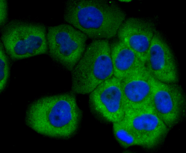 ICC staining of SCGB1A1 in A431 cells (green). Formalin fixed cells were permeabilized with 0.1% Triton X-100 in TBS for 10 minutes at room temperature and blocked with 1% Blocker BSA for 15 minutes at room temperature. Cells were probed with the primary antibody (ET7106-71, 1/50) for 1 hour at room temperature, washed with PBS. Alexa Fluor®488 Goat anti-Rabbit IgG was used as the secondary antibody at 1/1,000 dilution. The nuclear counter stain is DAPI (blue).