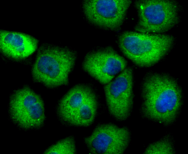 ICC staining of SCGB1A1 in HUVEC cells (green). Formalin fixed cells were permeabilized with 0.1% Triton X-100 in TBS for 10 minutes at room temperature and blocked with 1% Blocker BSA for 15 minutes at room temperature. Cells were probed with the primary antibody (ET7106-71, 1/50) for 1 hour at room temperature, washed with PBS. Alexa Fluor®488 Goat anti-Rabbit IgG was used as the secondary antibody at 1/1,000 dilution. The nuclear counter stain is DAPI (blue).