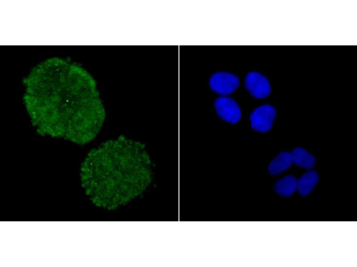 ICC staining of ADAR in Hela cells (green). Formalin fixed cells were permeabilized with 0.1% Triton X-100 in TBS for 10 minutes at room temperature and blocked with 10% negative goat serum for 15 minutes at room temperature. Cells were probed with the primary antibody (ET7106-72, 1/50) for 1 hour at room temperature, washed with PBS. Alexa Fluor®488 conjugate-Goat anti-Rabbit IgG was used as the secondary antibody at 1/1,000 dilution. The nuclear counter stain is DAPI (blue).