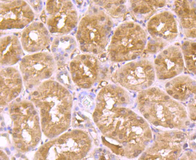Immunohistochemical analysis of paraffin-embedded human kidney tissue using anti-ADAR antibody. The section was pre-treated using heat mediated antigen retrieval with Tris-EDTA buffer (pH 9.0) for 20 minutes.The tissues were blocked in 1% BSA for 30 minutes at room temperature, washed with ddH2O and PBS, and then probed with the primary antibody (ET7106-72, 1/50) for 30 minutes at room temperature. The detection was performed using an HRP conjugated compact polymer system. DAB was used as the chromogen. Tissues were counterstained with hematoxylin and mounted with DPX.