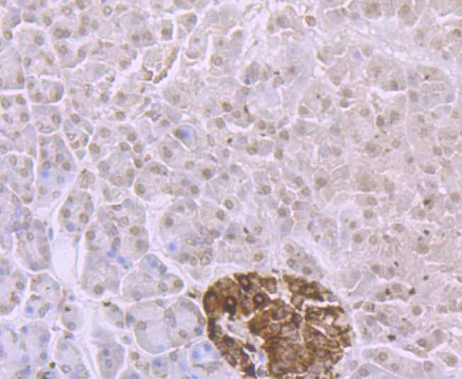 Immunohistochemical analysis of paraffin-embedded human pancreas tissue using anti-ADAR antibody. The section was pre-treated using heat mediated antigen retrieval with Tris-EDTA buffer (pH 9.0) for 20 minutes.The tissues were blocked in 1% BSA for 30 minutes at room temperature, washed with ddH2O and PBS, and then probed with the primary antibody (ET7106-72, 1/50) for 30 minutes at room temperature. The detection was performed using an HRP conjugated compact polymer system. DAB was used as the chromogen. Tissues were counterstained with hematoxylin and mounted with DPX.