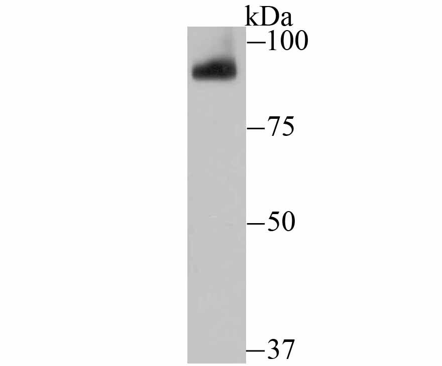 Western blot analysis of PIWIL1 on mouse testis tissue lysate using anti-PIWIL1 antibody at 1/500 dilution.