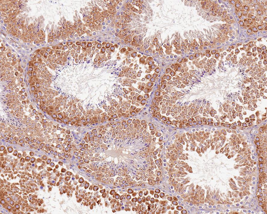 Immunohistochemical analysis of paraffin-embedded mouse testis tissue with Rabbit anti-PIWIL1 antibody (ET7106-73) at 1/200 dilution.<br />
<br />
The section was pre-treated using heat mediated antigen retrieval with Tris-EDTA buffer (pH 9.0) for 20 minutes. The tissues were blocked in 1% BSA for 20 minutes at room temperature, washed with ddH2O and PBS, and then probed with the primary antibody (ET7106-73) at 1/200 dilution for 1 hour at room temperature. The detection was performed using an HRP conjugated compact polymer system. DAB was used as the chromogen. Tissues were counterstained with hematoxylin and mounted with DPX.