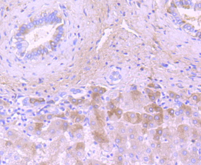 Immunohistochemical analysis of paraffin-embedded human liver tissue using anti-C3 antibody. Counter stained with hematoxylin.