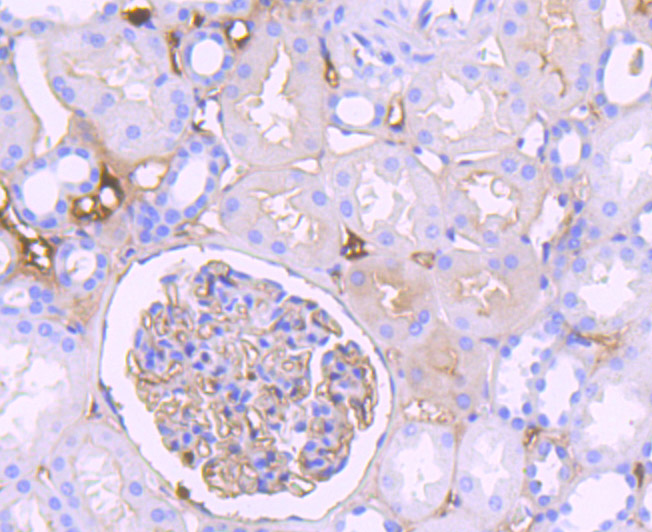 Immunohistochemical analysis of paraffin-embedded human kidney tissue using anti-C3 antibody. Counter stained with hematoxylin.
