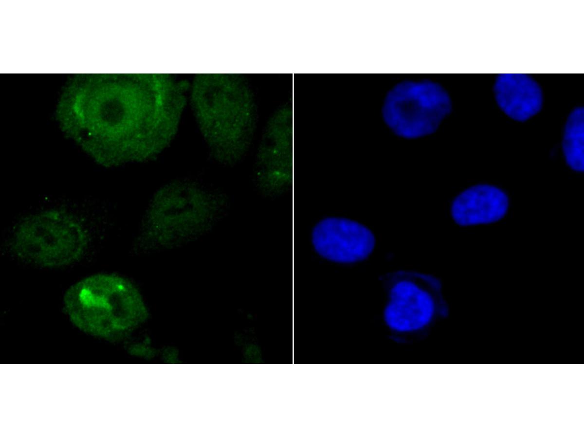 ICC staining Endo G in PC-3M cells (green). The nuclear counter stain is DAPI (blue). Cells were fixed in paraformaldehyde, permeabilised with 0.25% Triton X100/PBS.