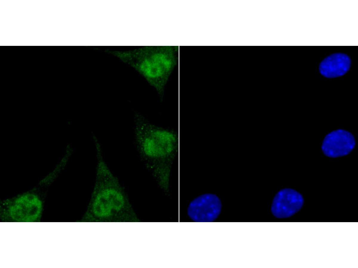 ICC staining Endo G in SH-SY5Y cells (green). The nuclear counter stain is DAPI (blue). Cells were fixed in paraformaldehyde, permeabilised with 0.25% Triton X100/PBS.