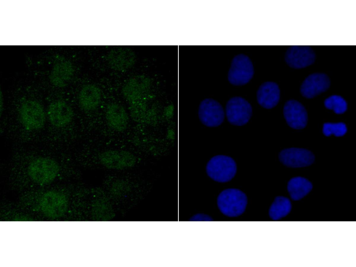 ICC staining Endo G in MCF-7 cells (green). The nuclear counter stain is DAPI (blue). Cells were fixed in paraformaldehyde, permeabilised