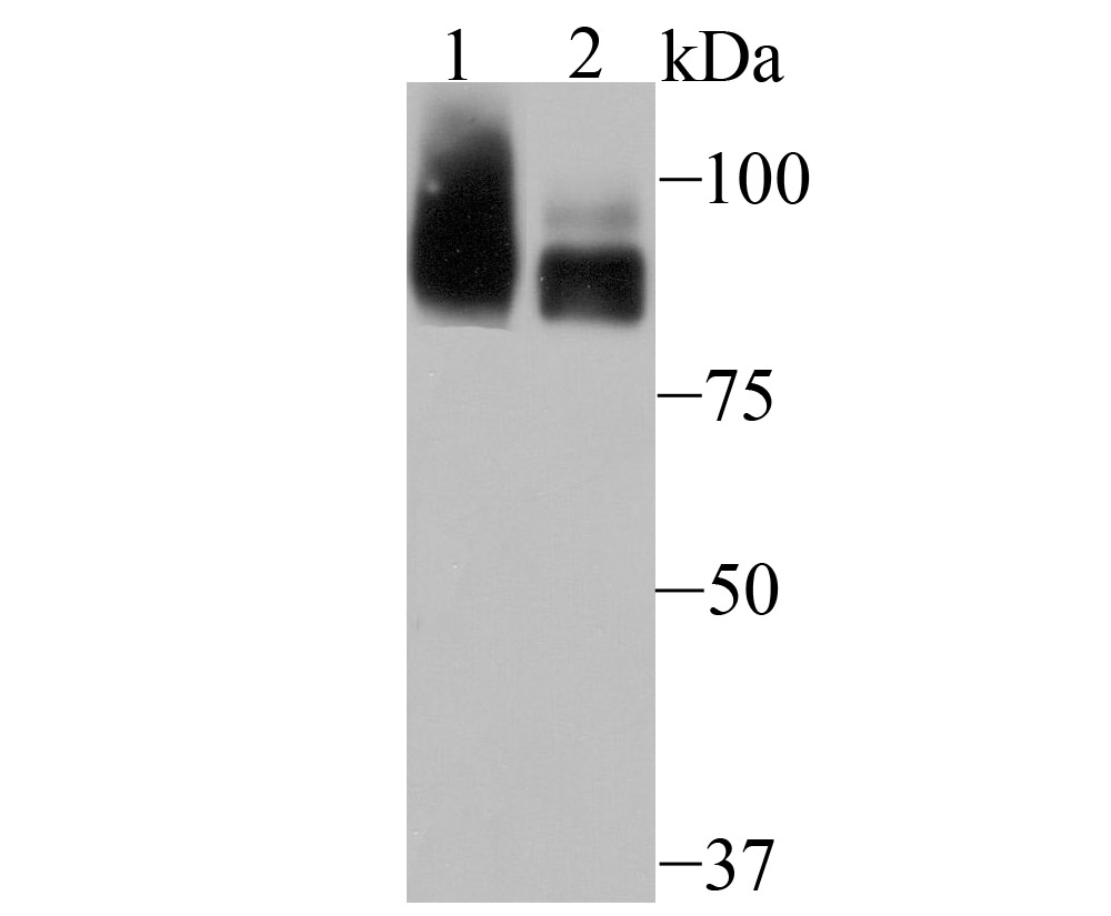 Western blot analysis of PCAF on rat kidney tissue (1) and K562 cell (2) lysate using anti-PCAF antibody at 1/500 dilution.
