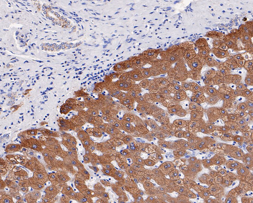 Immunohistochemical analysis of paraffin-embedded human liver tissue with Rabbit anti-PCK1 antibody (ET7106-81) at 1/200 dilution.<br />
<br />
The section was pre-treated using heat mediated antigen retrieval with Tris-EDTA buffer (pH 9.0) for 20 minutes. The tissues were blocked in 1% BSA for 20 minutes at room temperature, washed with ddH2O and PBS, and then probed with the primary antibody (ET7106-81) at 1/200 dilution for 1 hour at room temperature. The detection was performed using an HRP conjugated compact polymer system. DAB was used as the chromogen. Tissues were counterstained with hematoxylin and mounted with DPX.