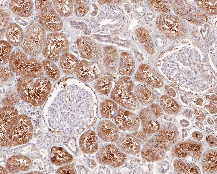 Immunohistochemical analysis of paraffin-embedded human kidney tissue with Rabbit anti-PCK1 antibody (ET7106-81) at 1/200 dilution.<br />
<br />
The section was pre-treated using heat mediated antigen retrieval with Tris-EDTA buffer (pH 9.0) for 20 minutes. The tissues were blocked in 1% BSA for 20 minutes at room temperature, washed with ddH2O and PBS, and then probed with the primary antibody (ET7106-81) at 1/200 dilution for 1 hour at room temperature. The detection was performed using an HRP conjugated compact polymer system. DAB was used as the chromogen. Tissues were counterstained with hematoxylin and mounted with DPX.