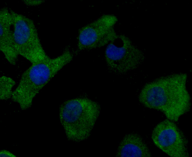 ICC staining of MMP17 in A549 cells (green). Formalin fixed cells were permeabilized with 0.1% Triton X-100 in TBS for 10 minutes at room temperature and blocked with 10% negative goat serum for 15 minutes at room temperature. Cells were probed with the primary antibody (ET7106-84, 1/50) for 1 hour at room temperature, washed with PBS. Alexa Fluor®488 conjugate-Goat anti-Rabbit IgG was used as the secondary antibody at 1/1,000 dilution. The nuclear counter stain is DAPI (blue).