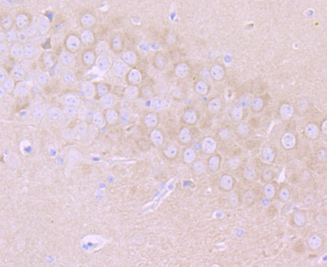 Immunohistochemical analysis of paraffin-embedded mouse brain tissue using anti-MMP17 antibody. The section was pre-treated using heat mediated antigen retrieval with Tris-EDTA buffer (pH 9.0) for 20 minutes.The tissues were blocked in 1% BSA for 30 minutes at room temperature, washed with ddH2O and PBS, and then probed with the primary antibody (ET7106-84, 1/50) for 30 minutes at room temperature. The detection was performed using an HRP conjugated compact polymer system. DAB was used as the chromogen. Tissues were counterstained with hematoxylin and mounted with DPX.
