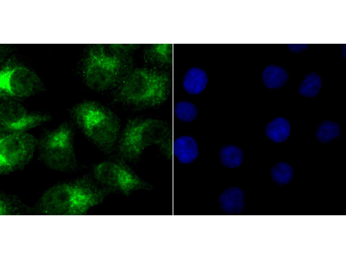 ICC staining NR0B1 in A549 cells (green). The nuclear counter stain is DAPI (blue). Cells were fixed in paraformaldehyde, permeabilised with 0.25% Triton X100/PBS.