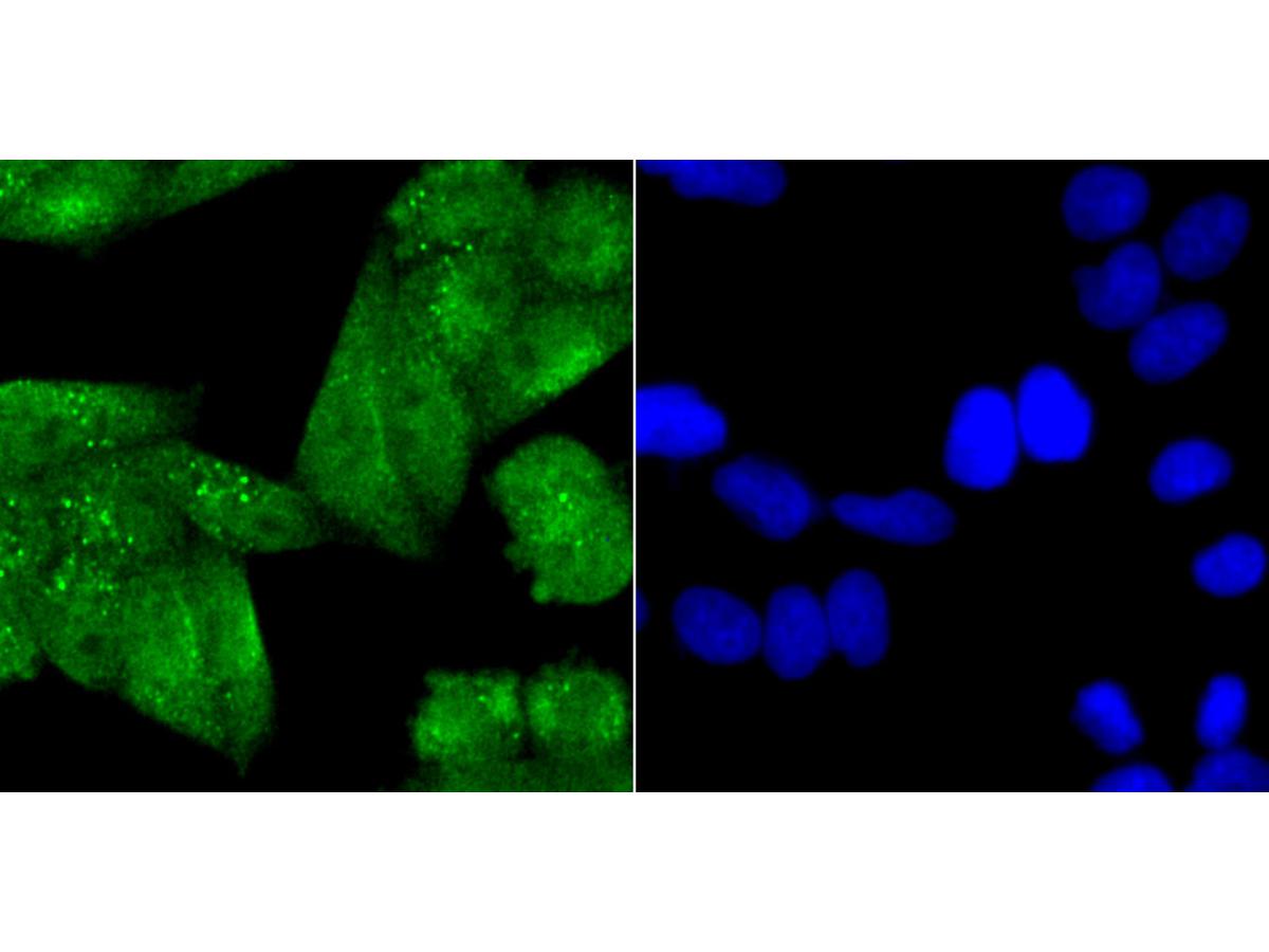 ICC staining NR0B1 in Hela cells (green). The nuclear counter stain is DAPI (blue). Cells were fixed in paraformaldehyde, permeabilised with 0.25% Triton X100/PBS.