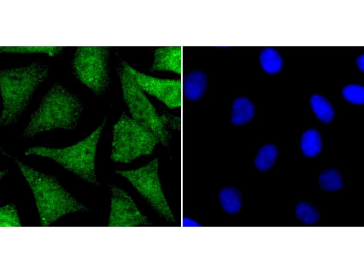 ICC staining NR0B1 in SH-SY-5Y cells (green). The nuclear counter stain is DAPI (blue). Cells were fixed in paraformaldehyde, permeabilised with 0.25% Triton X100/PBS.