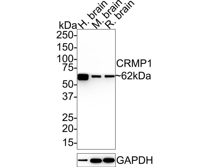 Western blot analysis of CRMP1 on mouse brain tissue lysate using anti-CRMP1 antibody at 1/500 dilution.
