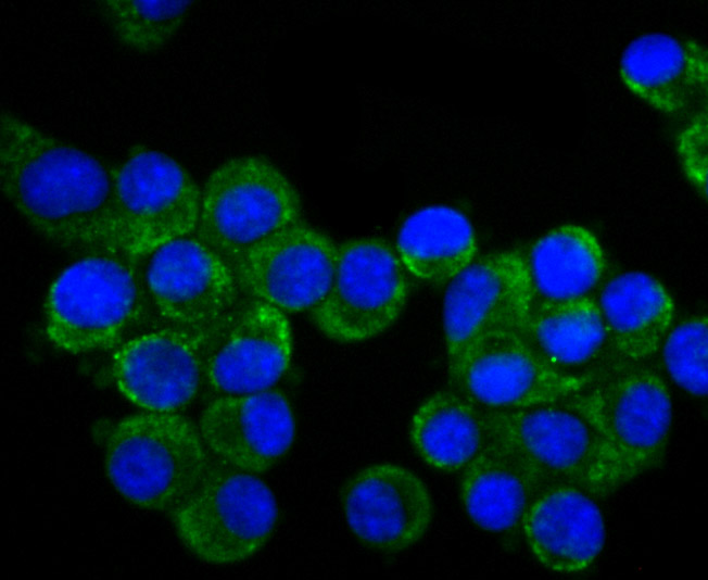 ICC staining CRMP1 in N2A cells (green). The nuclear counter stain is DAPI (blue). Cells were fixed in paraformaldehyde, permeabilised with 0.25% Triton X100/PBS.