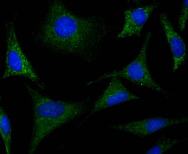 ICC staining CRMP1 in SH-SY5Y cells (green). The nuclear counter stain is DAPI (blue). Cells were fixed in paraformaldehyde, permeabilised with 0.25% Triton X100/PBS.