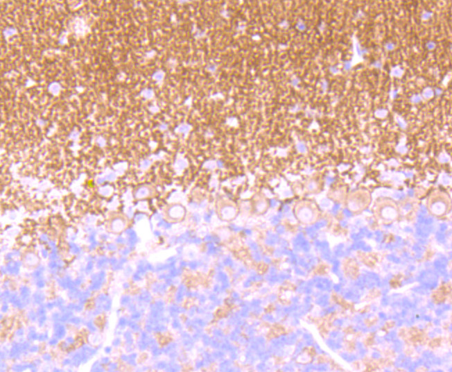 Immunohistochemical analysis of paraffin-embedded mouse brain tissue using anti- GABA B Receptor 2 antibody. Counter stained with hematoxylin.