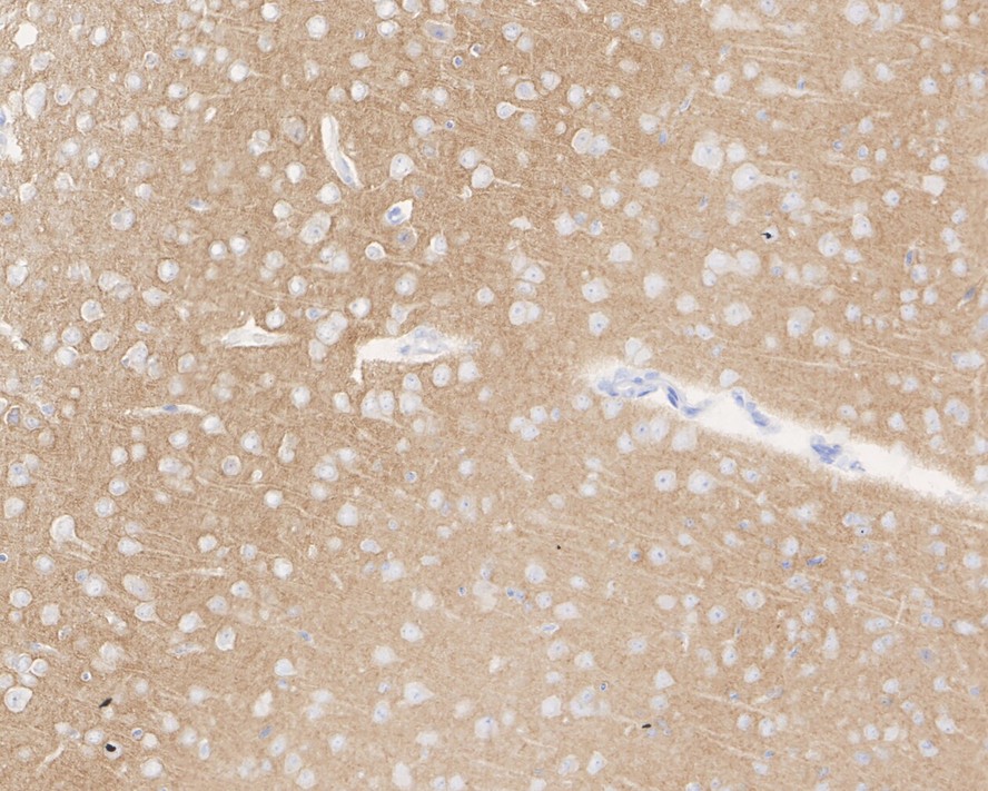 Immunohistochemical analysis of paraffin-embedded mouse cerebellum tissue using anti- GABA B Receptor 2 antibody. Counter stained with hematoxylin.