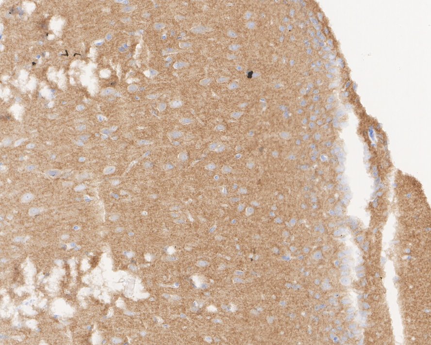 Immunohistochemical analysis of paraffin-embedded rat brain tissue using anti- GABA B Receptor 2 antibody. Counter stained with hematoxylin.