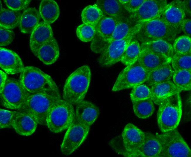 ICC staining Cellular Apoptosis Susceptibility in LOVO cells (green). The nuclear counter stain is DAPI (blue). Cells were fixed in paraformaldehyde, permeabilised with 0.25% Triton X100/PBS.